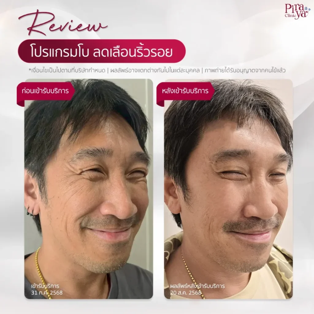 review | Piraya Clinic เมืองทอง