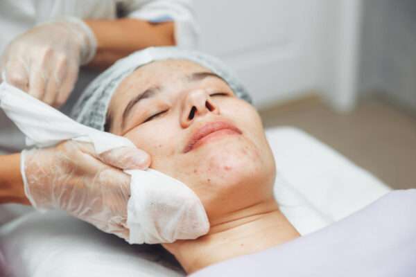 face treatment 04 | Piraya Clinic