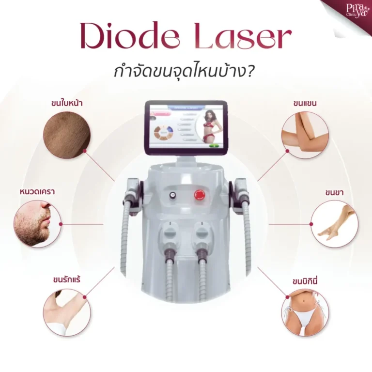 Diode Laser Body Part | Piraya Clinic เมืองทอง
