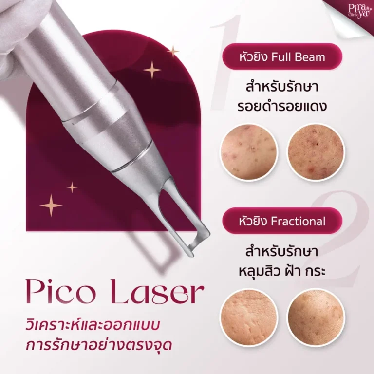 Piraya Pico Laser Handpiece | Piraya Clinic เมืองทอง