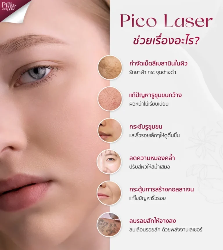 piraya clinic, ภิรญา คลินิก, คลิกนิกความงาม, คลินิก, ทำหน้า, หัตถการ, เมืองทอง, Pico Laser, Pico Laser ช่วยเรื่องอะไร