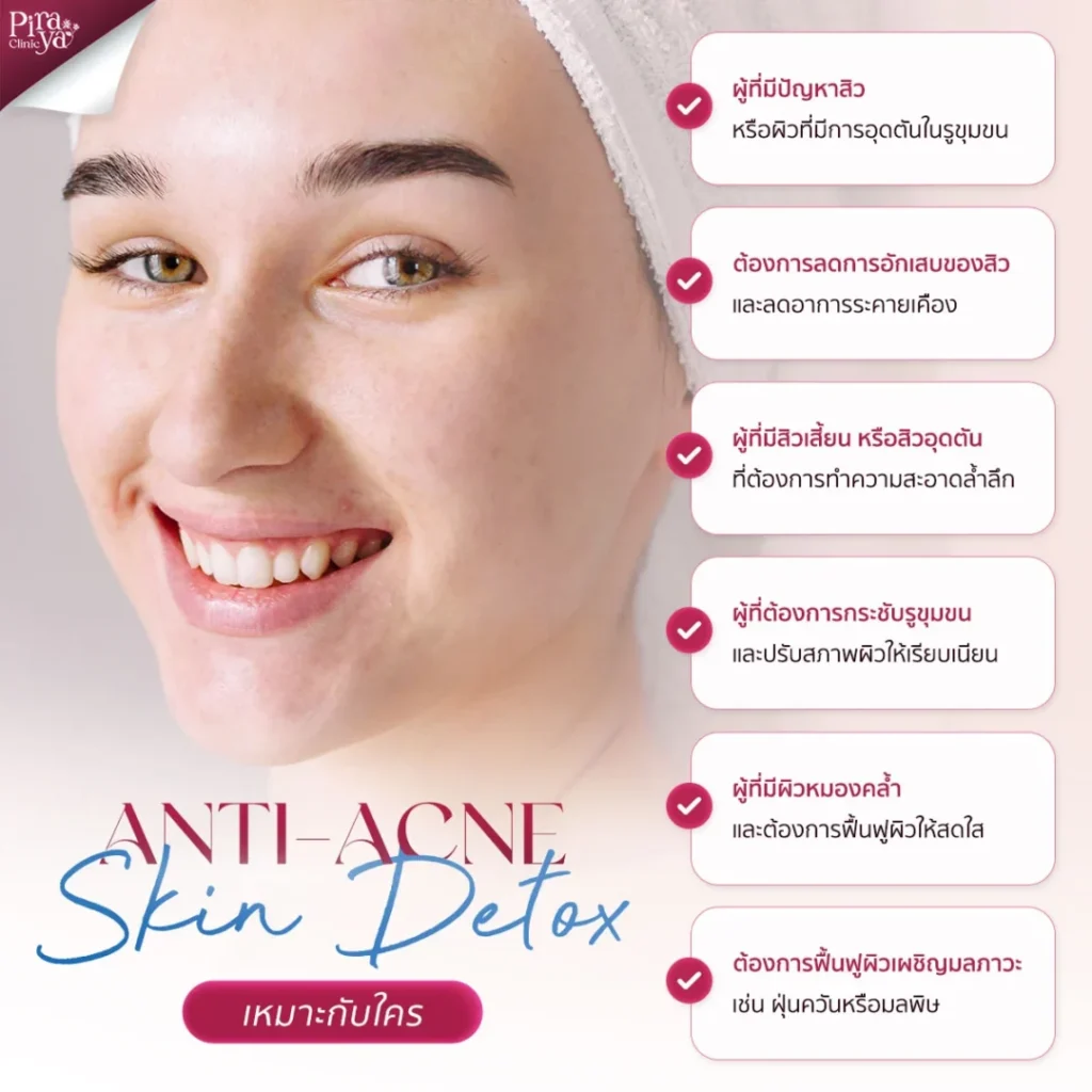 Anti-Acne Skin Detox เหมาะกับใคร, หน้าใสลดสิว, ฆ่าเชื้อสิว, ผิวกระจ่างใส, ทรีตเมนท์ผิวหน้า, piraya clinic, ภิรญา คลินิก, คลิกนิกความงาม, คลินิก, ทำหน้า, หัตถการ, เมืองทอง, ทรีตเมนท์