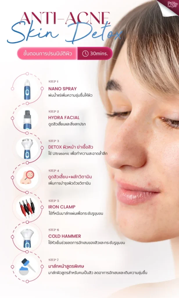ขั้นตอนการทำ Anti-Acne Skin Detox, หน้าใสลดสิว, ฆ่าเชื้อสิว, ผิวกระจ่างใส, ทรีตเมนท์ผิวหน้า, piraya clinic, ภิรญา คลินิก, คลิกนิกความงาม, คลินิก, ทำหน้า, หัตถการ, เมืองทอง, ทรีตเมนท์