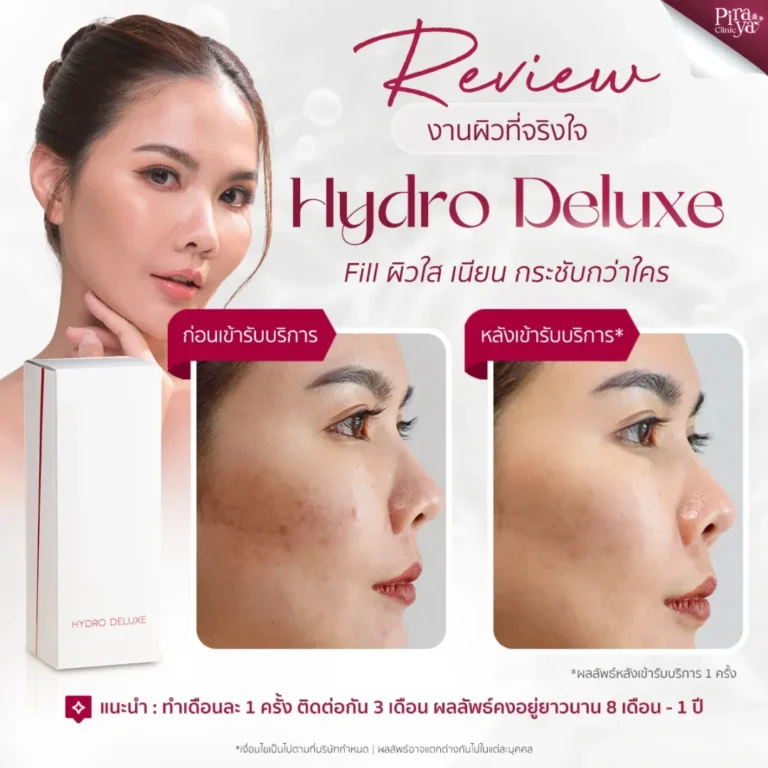 Hydro Deluxe Review, Piraya Clinic, ภิรญา คลินิก, คลิกนิกความงาม, คลินิก, ทำหน้า, หัตถการ, เมืองทอง