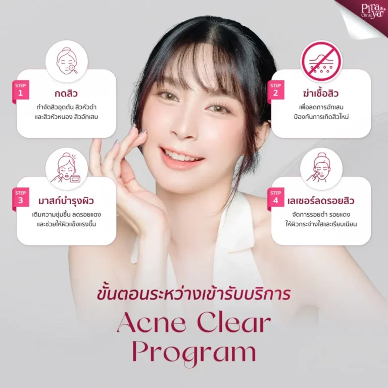 ขั้นตอนระหว่างเข้ารับบริการโปรแกรมรักษาสิวครบวงจร 4 ขั้นตอน