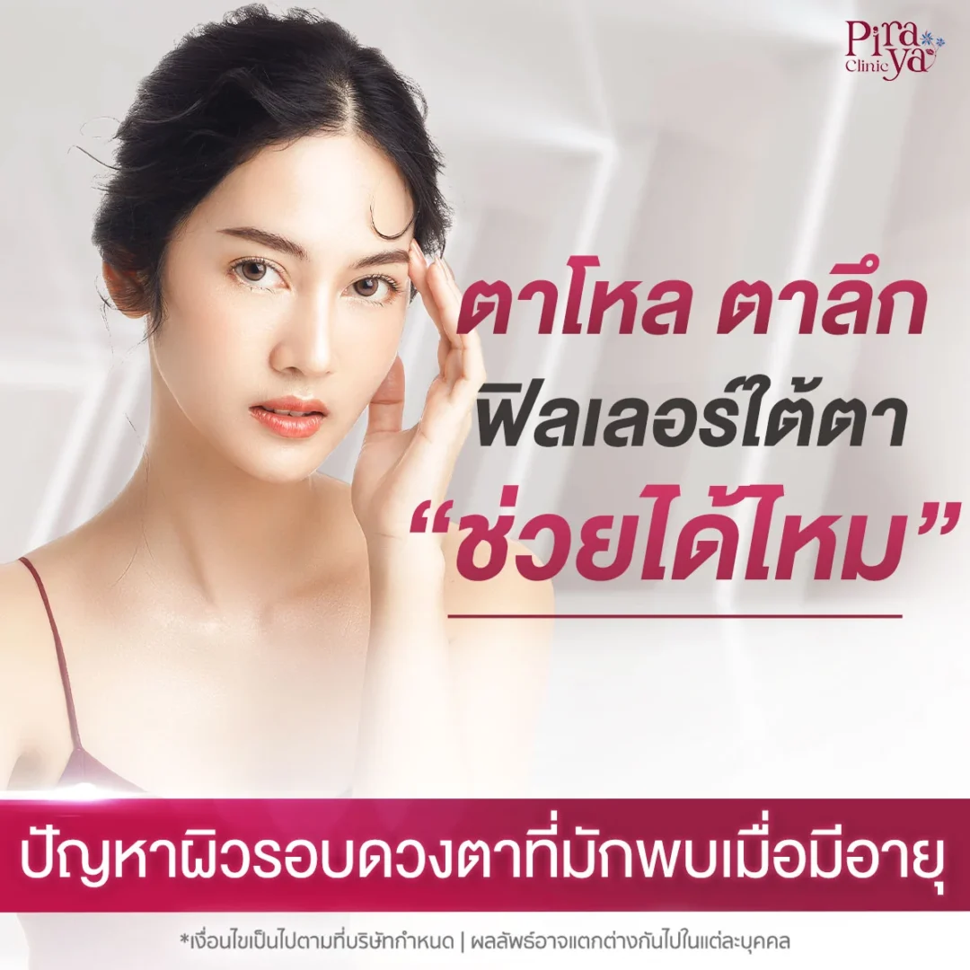 ตาโหล เบ้าตาลึก ฟิลเลอร์ใต้ตาช่วยได้ไหม?