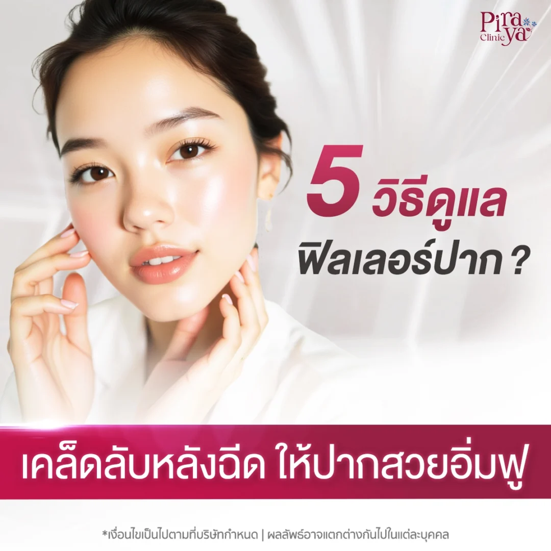 5 วิธีดูแลหลังฉีดฟิลเลอร์