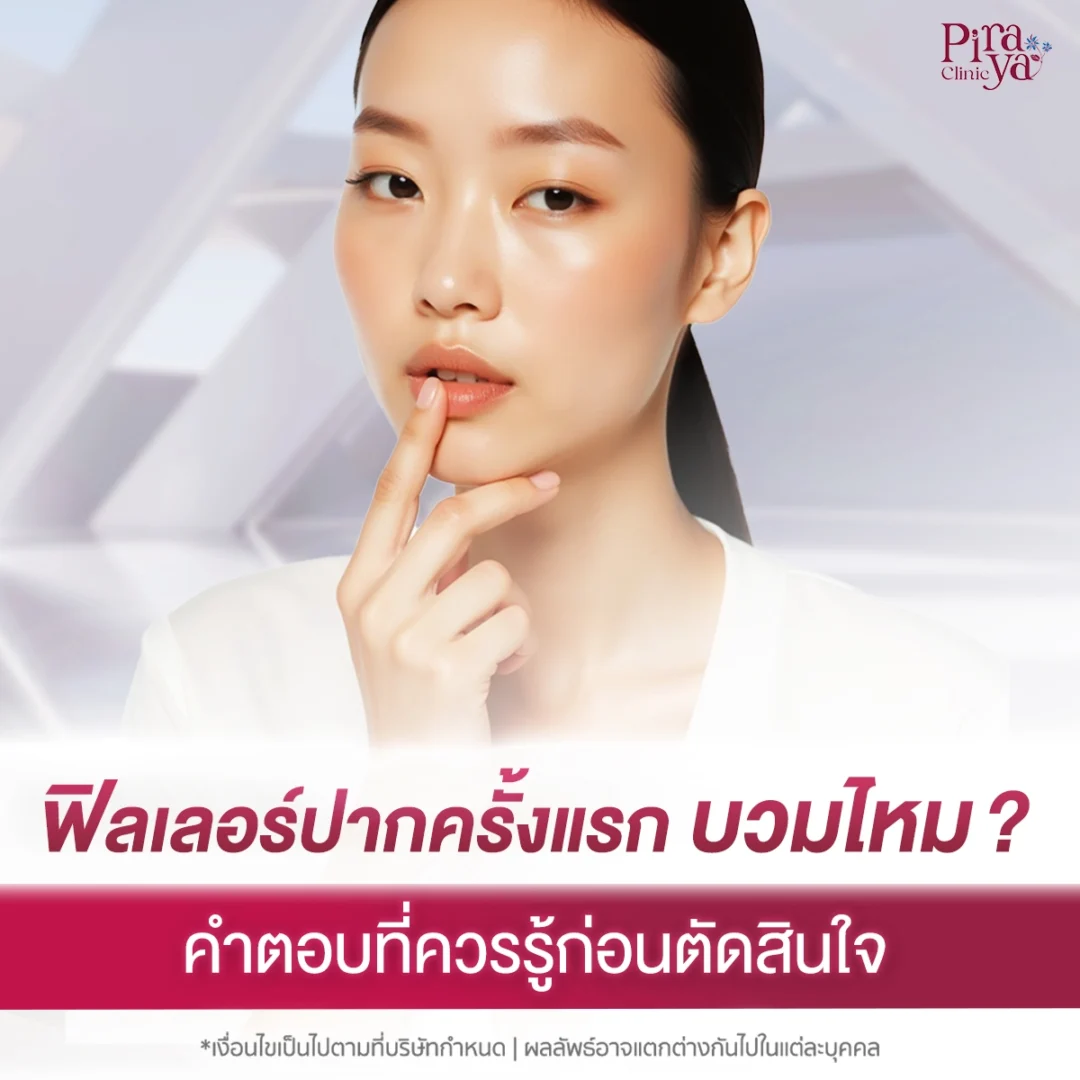 ฟิลเลอร์ครั้งแรก บวมไหม?