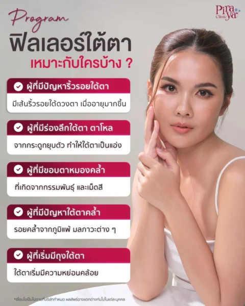 ฟิลเลอร์ใต้ตา เหมาะกับใคร