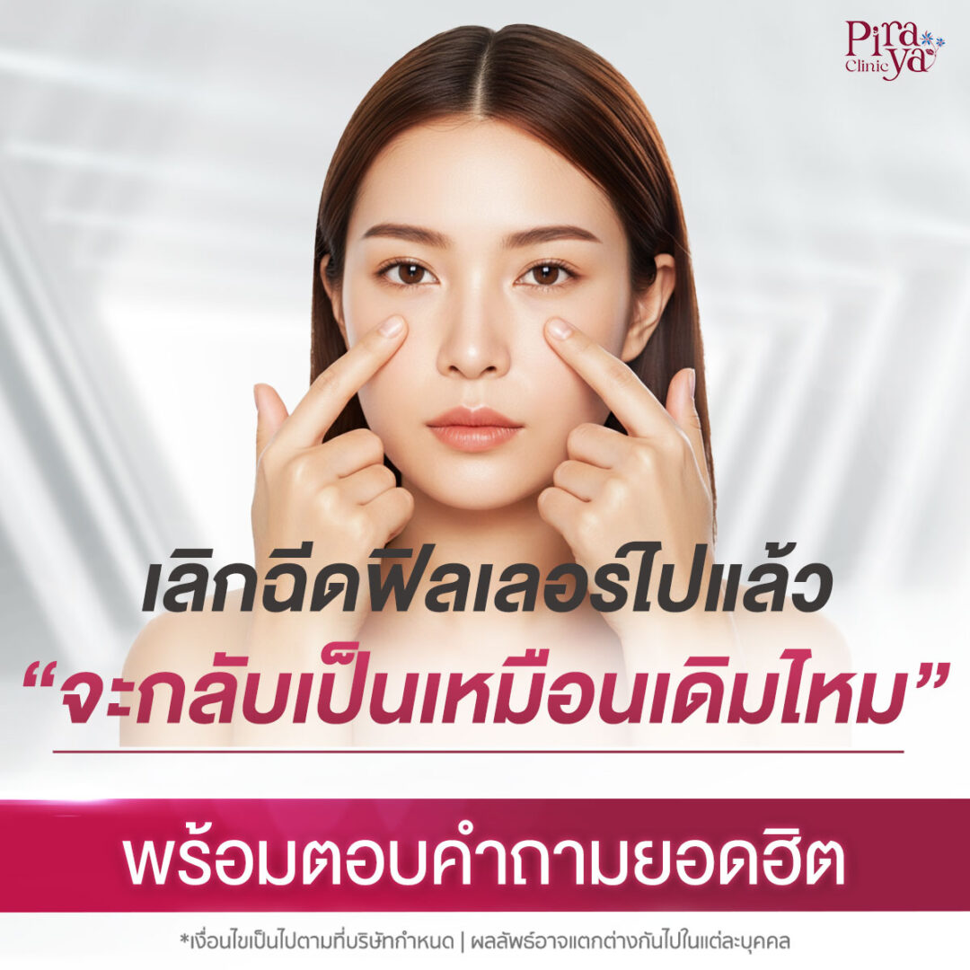 เลิกฉีดฟิลเลอร์ไปแล้ว หน้าจะกลับมาเป็นเหมือนเดิมไหม