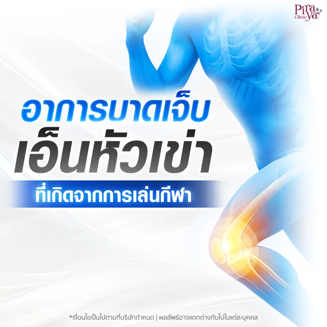 อาการบาดเจ็บเอ็นหัวเข่าจากการเล่นกีฬา