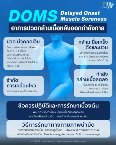 Delayed Onset Muscle Soreness (DOMS)