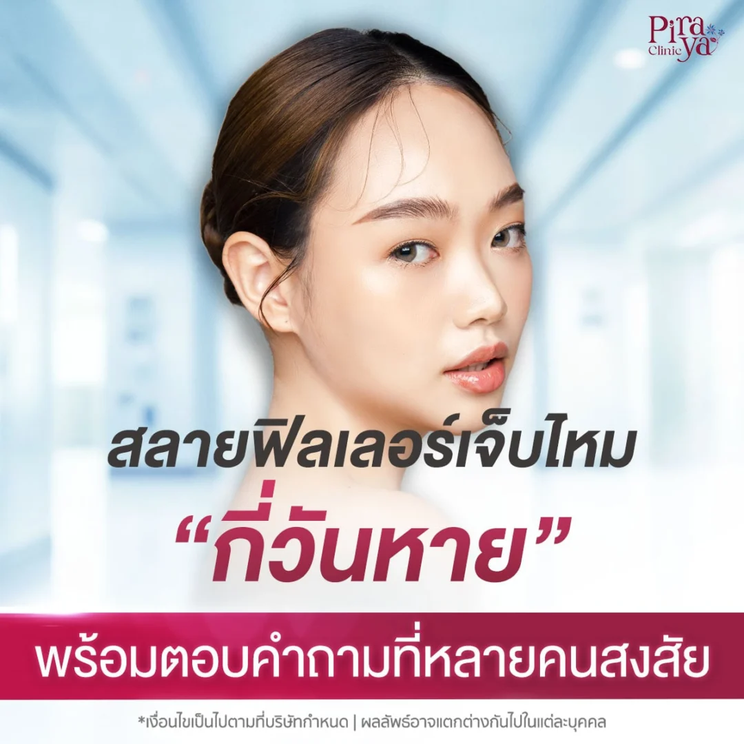 สลายฟิลเลอร์เจ็บไหม กี่วันหาย