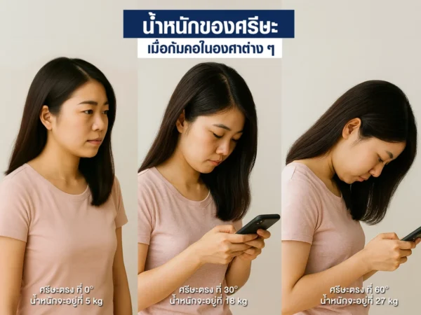 น้ำหนักของศรีษะในขณะที่ก้มหน้าเล่นมือถือในองศาต่างๆ