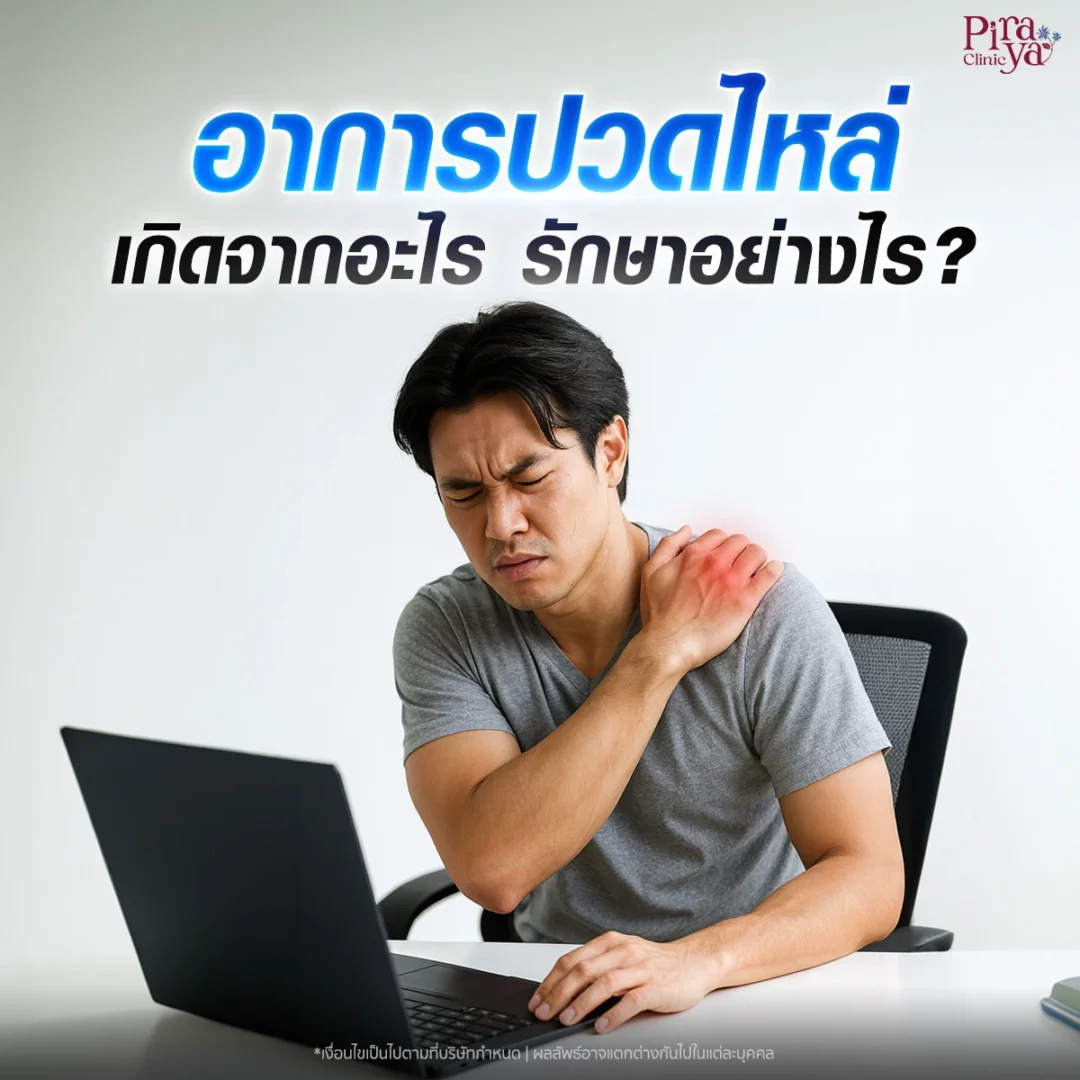 ปวดไหล่ทำยังไงดี ? เกิดจากอะไร และรักษาแบบไหนได้บ้าง